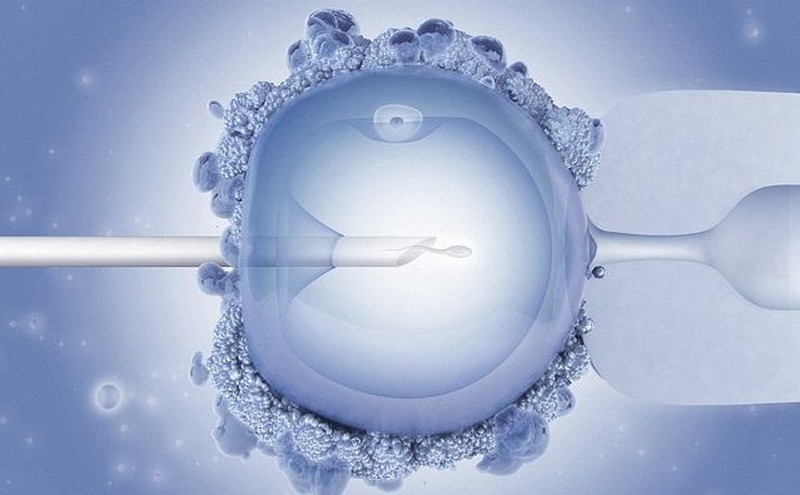 40 ans après la 1ère fécondation in vitro, plus de 8 millions d'enfants dans le monde sont nés par procréation médicalement assistée (PMA)_ICSI_wp