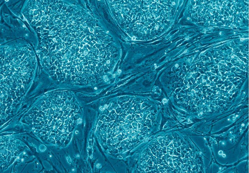 Le clonage_cellules-souches-embryonnaires_wp