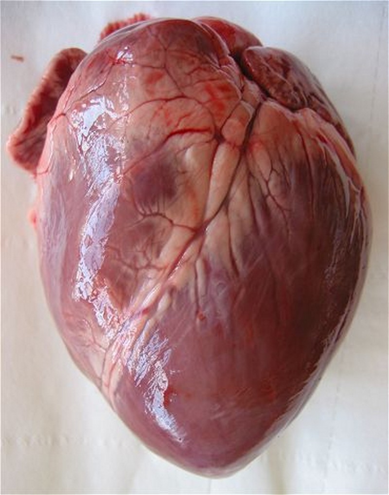 Le cœur génétiquement modifié d'un cochon implanté chez un homme_wp